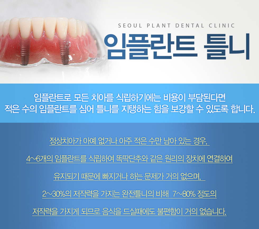 ���ö�Ʈ Ʋ��